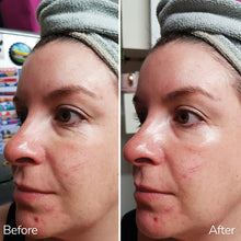 Ultra Care+ Platinum Advanced Eye & Lip Treatment