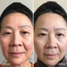 Before and after comparison showing visible firming results from Nutrimetics (TFF) Advanced Tight Firm & Fill Face Serum in Australia